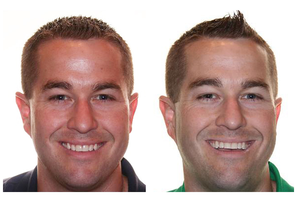 Family Dental Care NC