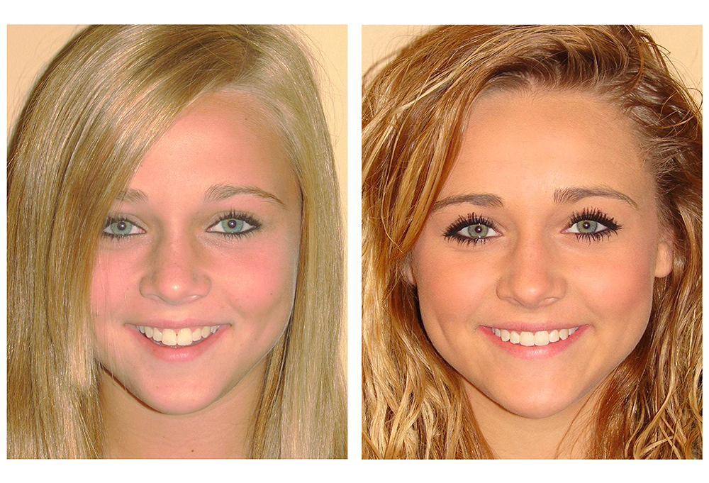 Family Dental Care NC